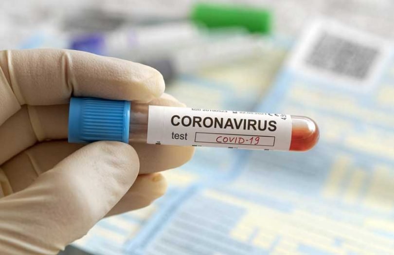 coronavirus test covid 19 810x524 1